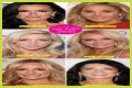Botox, Implants & More! – Hollywood Life