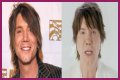 John Rzeznik Facelift | Goo Goo Dolls Frontman Plastic Surgery Before And After